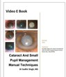 Cataract And Small Pupil Management Manual Techniques - Sudhir Singh - 9798201201784
