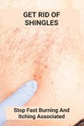 Get Rid Of Shingles: Stop Fast Burning And Itching Associated: Shingles On Face Treatment - Mana Voetmann - 9798738312823